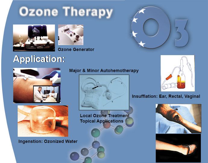 Amazing Benefits Of Ozone Therapy Regenerative 21